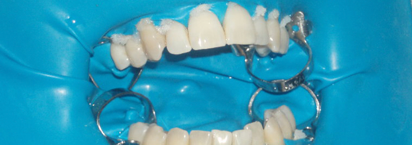 Diploma de Especialización en Técnicas de Blanqueamiento Dental